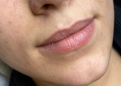 Permanent Make Up Lippen Behandlung Rottenburg vorher